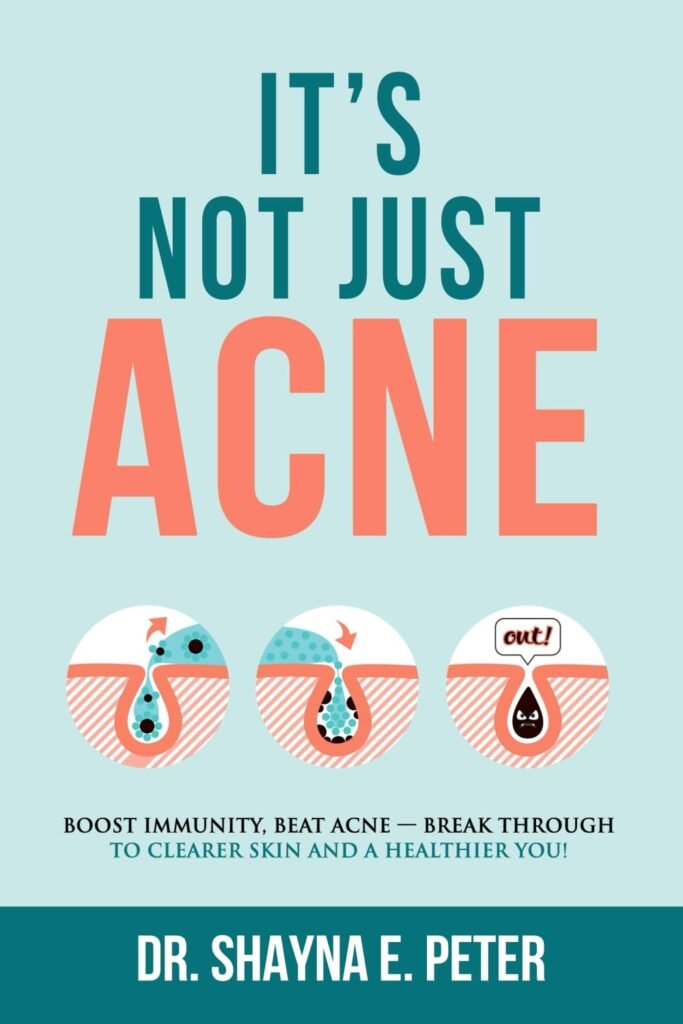 Its Not Just Acne: Boost Immunity, Beat Acne - Break Through to Clearer Skin  A Healthier You!      Paperback – January 2, 2021